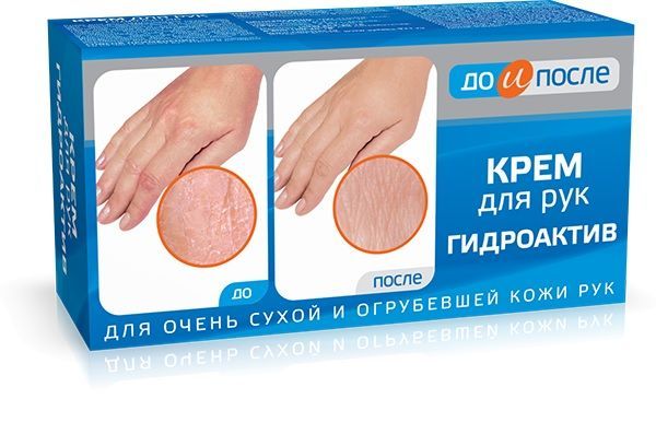 До и после гидроактив крем для сухой кожи рук 100мл